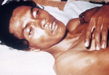 تفشي الكوليرا في السودان تفشي الكوليرا في السودان