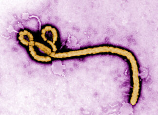WHO Warns Ebola Outbreak Could Be Wider Than Reported Ebola