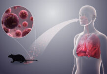What You Should Know About Hantavirus! HantaVirus