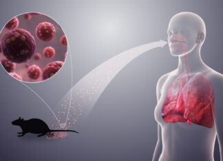 What You Should Know About Hantavirus! HantaVirus